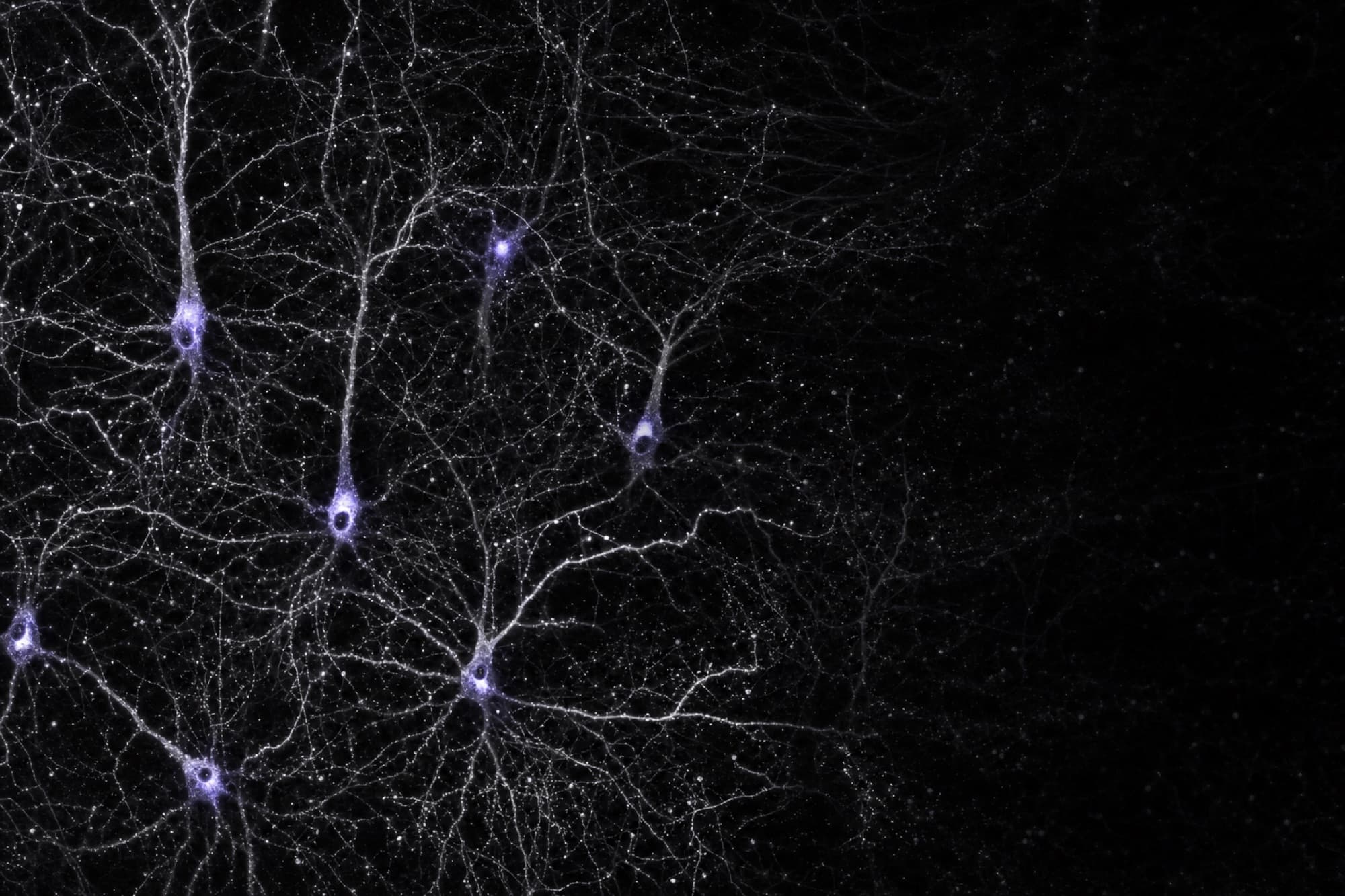 Cortical neurons, confocal micrograph